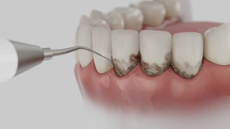 Trusted Root Canal Treatment service in Harbor Beach, MI - Dentist Open Now